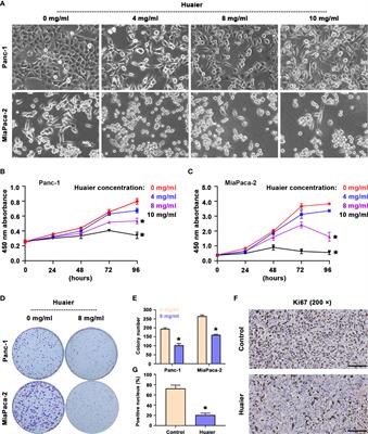 Huaier suppresses pancreatic cancer progression via activating cell autophagy induced ferroptosis